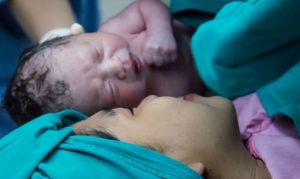 Newborn after Caesarean